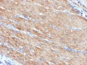 Immunohistochemistry (Formalin/PFA-fixed paraffin-embedded sections) - Anti-smooth muscle Myosin heavy chain I antibody [MYH11/923] (AB233940)