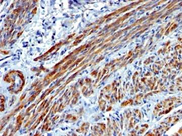 Immunohistochemistry (Formalin/PFA-fixed paraffin-embedded sections) - Anti-smooth muscle Myosin heavy chain I antibody [MYH11/923] (AB233940)