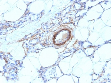 Immunohistochemistry (Formalin/PFA-fixed paraffin-embedded sections) - Anti-smooth muscle Myosin heavy chain I antibody [MYH11/923] (AB233940), expandable thumbnail