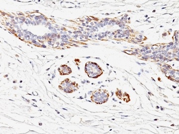 Immunohistochemistry (Formalin/PFA-fixed paraffin-embedded sections) - Anti-smooth muscle Myosin heavy chain I antibody [MYH11/923] (AB233940), expandable thumbnail