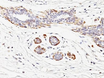 Immunohistochemistry (Formalin/PFA-fixed paraffin-embedded sections) - Anti-smooth muscle Myosin heavy chain I antibody [MYH11/923] (AB233940)