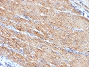 Immunohistochemistry (Formalin/PFA-fixed paraffin-embedded sections) - Anti-smooth muscle Myosin heavy chain I antibody [MYH11/923] - BSA and Azide free (AB212660), expandable thumbnail