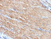 Immunohistochemistry (Formalin/PFA-fixed paraffin-embedded sections) - Anti-smooth muscle Myosin heavy chain I antibody [MYH11/923] - BSA and Azide free (AB212660)