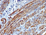 Immunohistochemistry (Formalin/PFA-fixed paraffin-embedded sections) - Anti-smooth muscle Myosin heavy chain I antibody [MYH11/923] - BSA and Azide free (AB212660), expandable thumbnail