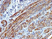 Immunohistochemistry (Formalin/PFA-fixed paraffin-embedded sections) - Anti-smooth muscle Myosin heavy chain I antibody [MYH11/923] - BSA and Azide free (AB212660)