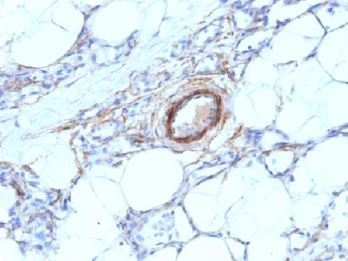 Immunohistochemistry (Formalin/PFA-fixed paraffin-embedded sections) - Anti-smooth muscle Myosin heavy chain I antibody [MYH11/923] - BSA and Azide free (AB212660), expandable thumbnail