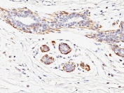 Immunohistochemistry (Formalin/PFA-fixed paraffin-embedded sections) - Anti-smooth muscle Myosin heavy chain I antibody [MYH11/923] - BSA and Azide free (AB212660), expandable thumbnail