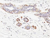 Immunohistochemistry (Formalin/PFA-fixed paraffin-embedded sections) - Anti-smooth muscle Myosin heavy chain I antibody [MYH11/923] - BSA and Azide free (AB212660)
