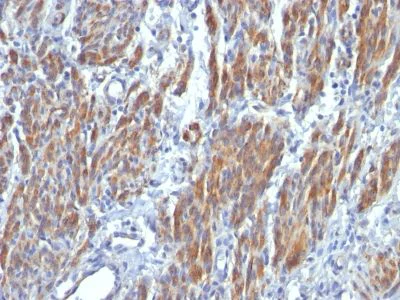 Immunohistochemistry (Formalin/PFA-fixed paraffin-embedded sections) - Anti-smooth muscle Myosin heavy chain I antibody [SMMS-1] (AB233939)