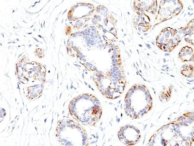 Immunohistochemistry (Formalin/PFA-fixed paraffin-embedded sections) - Anti-smooth muscle Myosin heavy chain I antibody [SMMS-1] (AB233939)