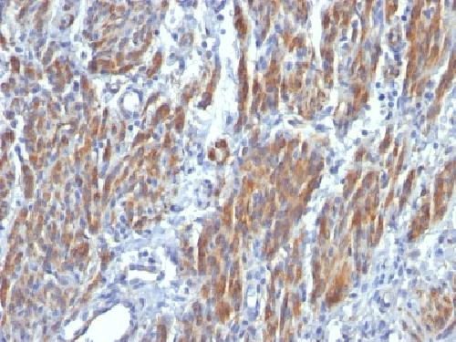 Immunohistochemistry (Formalin/PFA-fixed paraffin-embedded sections) - Anti-smooth muscle Myosin heavy chain I antibody [SMMS-1] - BSA and Azide free (AB212657)