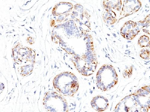 Immunohistochemistry (Formalin/PFA-fixed paraffin-embedded sections) - Anti-smooth muscle Myosin heavy chain I antibody [SMMS-1] - BSA and Azide free (AB212657)