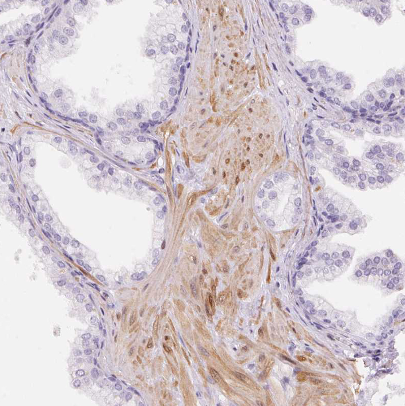 Immunohistochemistry (Formalin/PFA-fixed paraffin-embedded sections) - Anti-Smoothelin antibody (AB204305)