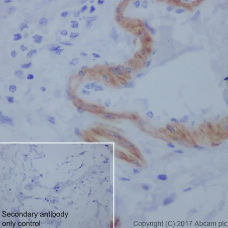 Immunohistochemistry (Formalin/PFA-fixed paraffin-embedded sections) - Anti-Smoothelin antibody [EPR20044] (AB219652)
