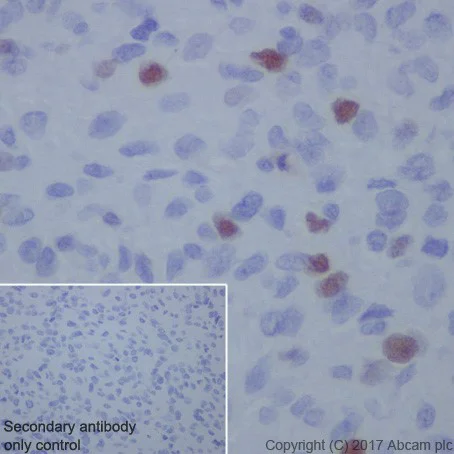 Immunohistochemistry (Formalin/PFA-fixed paraffin-embedded sections) - Anti-Smoothelin antibody [EPR20044] (AB219652)