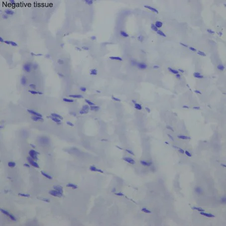 Immunohistochemistry (Formalin/PFA-fixed paraffin-embedded sections) - Anti-Smoothelin antibody [EPR20044] (AB219652)