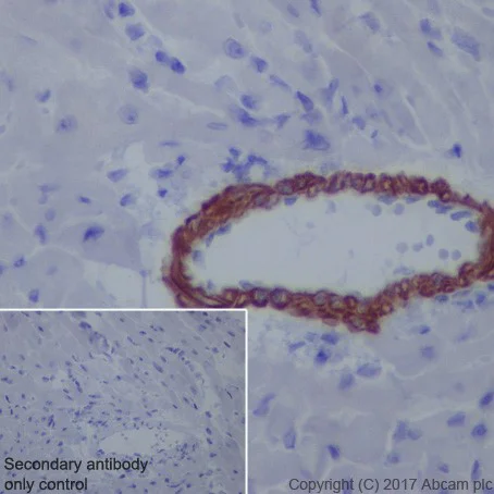 Immunohistochemistry (Formalin/PFA-fixed paraffin-embedded sections) - Anti-Smoothelin antibody [EPR20044] (AB219652)
