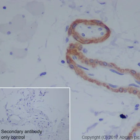 Immunohistochemistry (Formalin/PFA-fixed paraffin-embedded sections) - Anti-Smoothelin antibody [EPR20044] (AB219652)