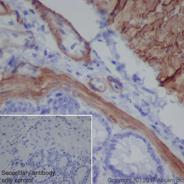 Immunohistochemistry (Formalin/PFA-fixed paraffin-embedded sections) - Anti-Smoothelin antibody [EPR20044] (AB219652)