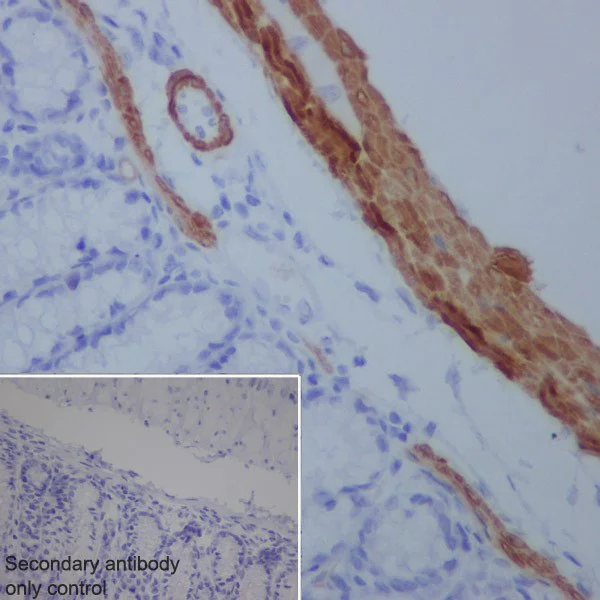 Immunohistochemistry (Formalin/PFA-fixed paraffin-embedded sections) - Anti-Smoothelin antibody [EPR20044] (AB219652)