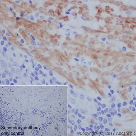 Immunohistochemistry (Formalin/PFA-fixed paraffin-embedded sections) - Anti-Smoothelin antibody [EPR20044] (AB219652)