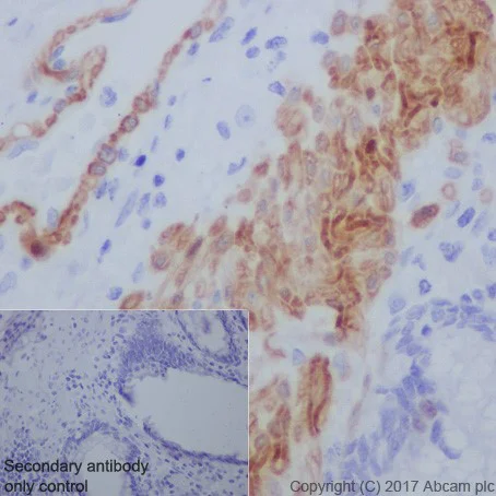 Immunohistochemistry (Formalin/PFA-fixed paraffin-embedded sections) - Anti-Smoothelin antibody [EPR20044] (AB219652)