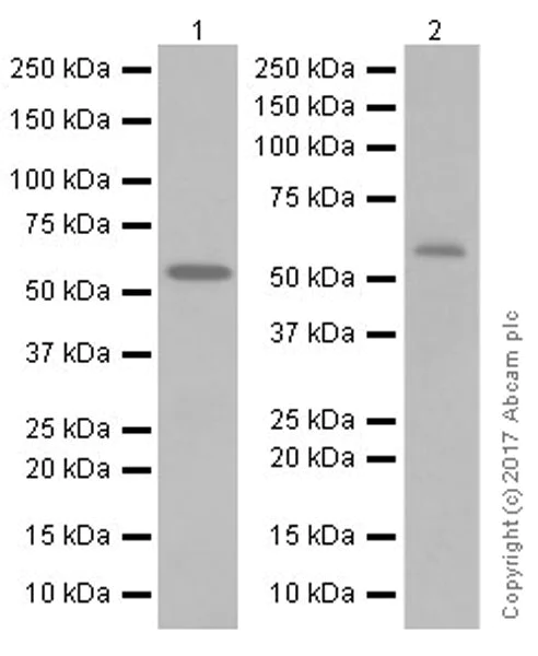 Western blot - Anti-Smoothelin antibody [EPR20044] (AB219652)