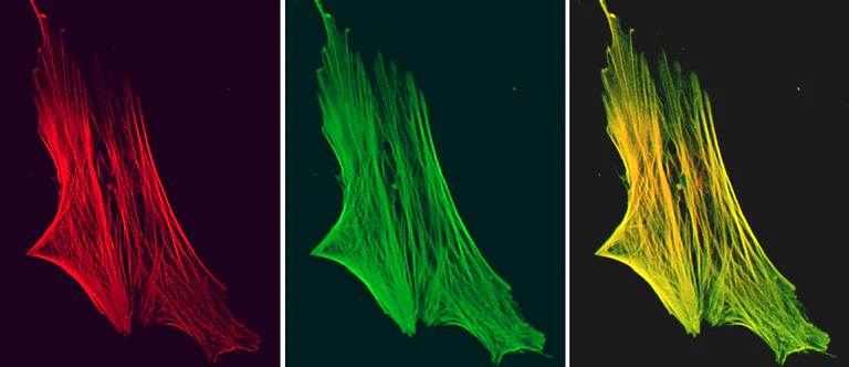Immunocytochemistry/ Immunofluorescence - Anti-Smoothelin antibody [R4A] (AB8969)