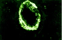 Immunocytochemistry/ Immunofluorescence - Anti-Smoothelin antibody [R4A] (AB8969)