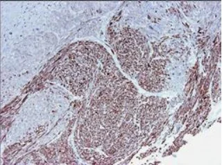 Immunohistochemistry (Formalin/PFA-fixed paraffin-embedded sections) - Anti-Smoothelin antibody [R4A] (AB8969)