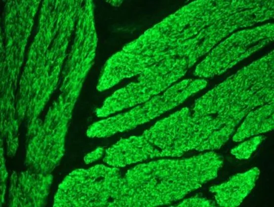 Immunohistochemistry (Frozen sections) - Anti-Smoothelin antibody [R4A] (AB8969)