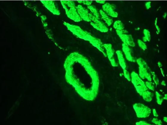Immunohistochemistry (Frozen sections) - Anti-Smoothelin antibody [R4A] (AB8969)