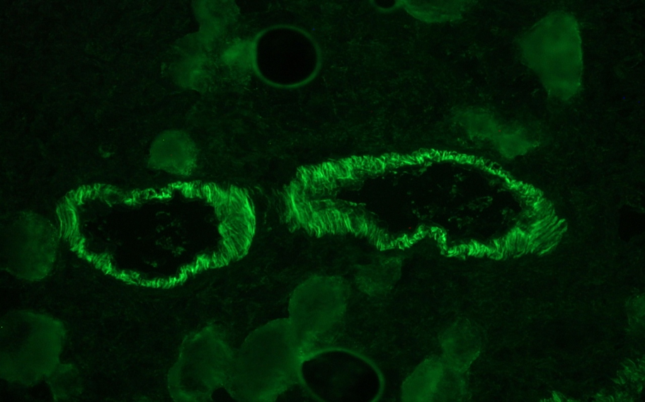 Anti-Smoothelin antibody [R4A]