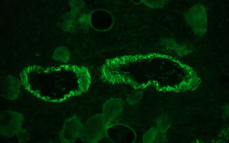 aminaseページ Anti-Sodium Potassium ATPase antibody [EP1845Y] - Mouse IgG1