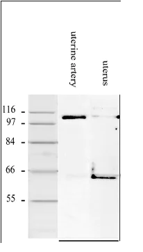 Western blot - Anti-Smoothelin antibody [R4A] (AB8969)