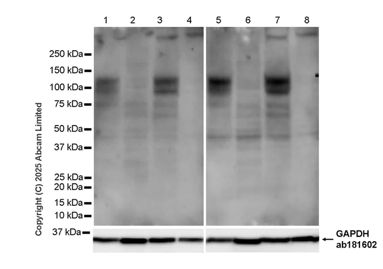 Western blot - Anti-Smoothened antibody [18-10-10] (AB325489)
