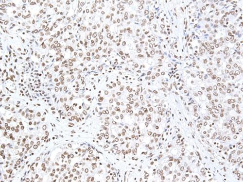 Immunohistochemistry (Formalin/PFA-fixed paraffin-embedded sections) - Anti-Smoothened antibody (AB235183)