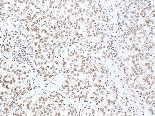 Immunohistochemistry (Formalin/PFA-fixed paraffin-embedded sections) - Anti-Smoothened antibody (AB235183)