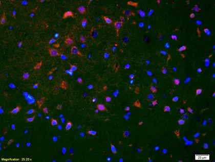 Immunofluorescence - Anti-Smoothened antibody (AB236465)
