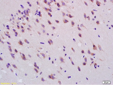 Immunohistochemistry (Formalin/PFA-fixed paraffin-embedded sections) - Anti-Smoothened antibody (AB236465)