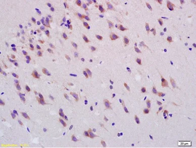 Immunohistochemistry (Formalin/PFA-fixed paraffin-embedded sections) - Anti-Smoothened antibody (AB236465)