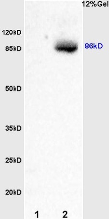 Western blot - Anti-Smoothened antibody (AB236465)