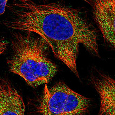 Immunocytochemistry/ Immunofluorescence - Anti-SMOX antibody (AB150971), expandable thumbnail