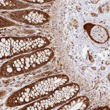 Immunohistochemistry (Formalin/PFA-fixed paraffin-embedded sections) - Anti-SMOX antibody (AB150971), expandable thumbnail