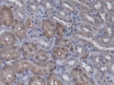 Immunohistochemistry (Formalin/PFA-fixed paraffin-embedded sections) - Anti-SMP30 antibody (AB231322)