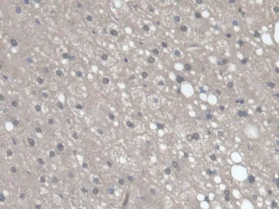 Immunohistochemistry (Formalin/PFA-fixed paraffin-embedded sections) - Anti-SMP30 antibody (AB233007)