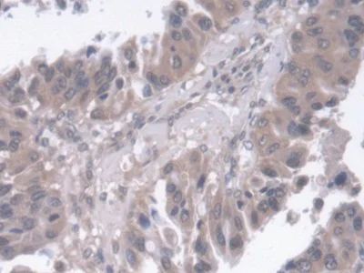 Immunohistochemistry (Formalin/PFA-fixed paraffin-embedded sections) - Anti-SMP30 antibody (AB233007)