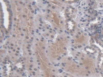Immunohistochemistry (Formalin/PFA-fixed paraffin-embedded sections) - Anti-SMP30 antibody (AB233007)