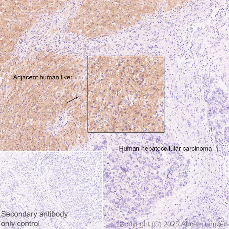 Immunohistochemistry (Formalin/PFA-fixed paraffin-embedded sections) - Anti-SMP30 antibody [EPR29674-517] (AB324949)