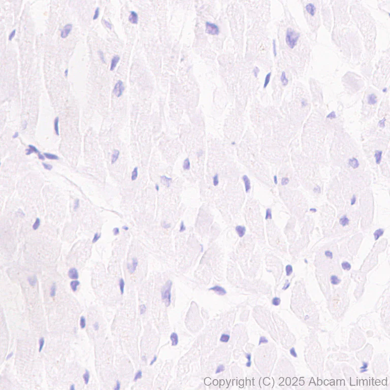 Immunohistochemistry (Formalin/PFA-fixed paraffin-embedded sections) - Anti-SMP30 antibody [EPR29674-517] (AB324949)
